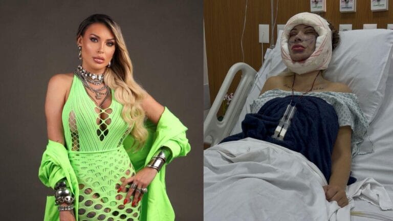 Andressa Urach viraliza ao fazer 50ª cirurgia plástica