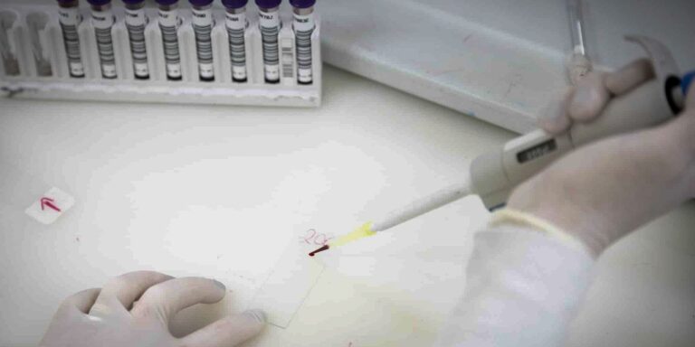 Atualização: Paciente em SP com suspeita de ebola tem meningite