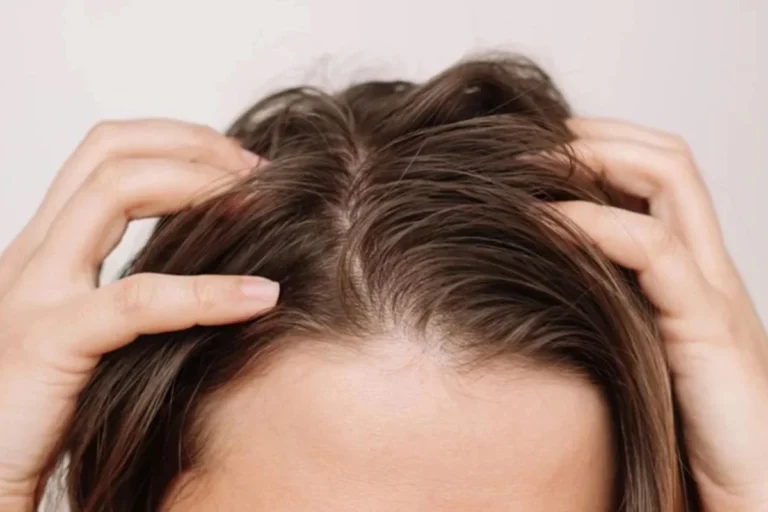 Dicas para cabelo sem brilho e com frizz: truque caseiro eficaz