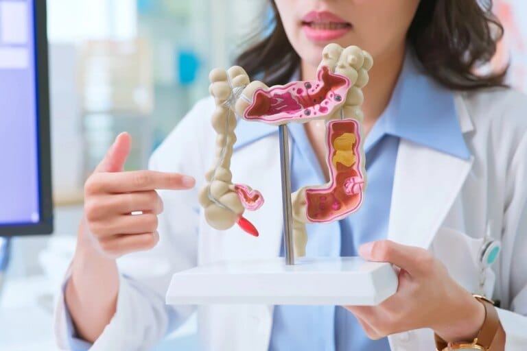 Probiótico e prebiótico: dicas para saúde intestinal e bem-estar