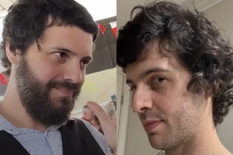 Saúde e bem-estar: Defante muda visual e dá dicas de estilo