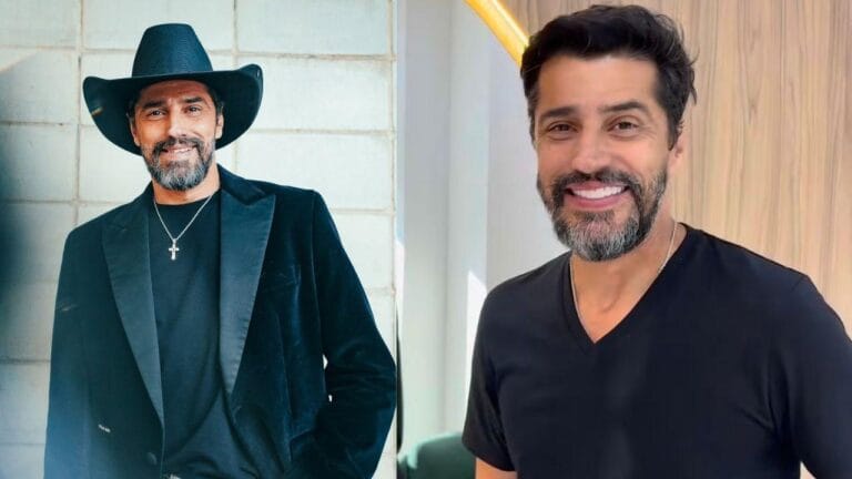 Viral: Ex-BBB Alberto Cowboy coloca lentes de contato nos dentes