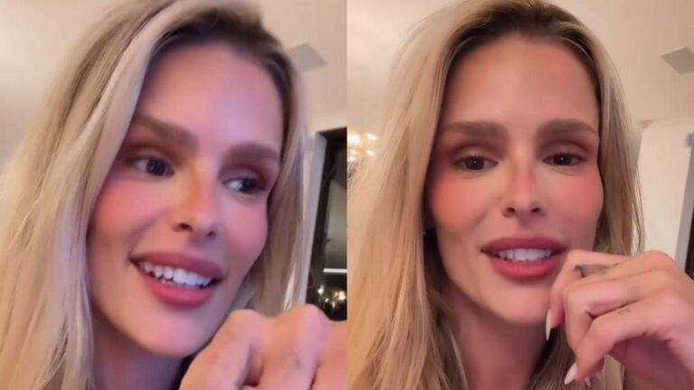 Viral: Yasmin Brunet revela situação inusitada sobre lipedema