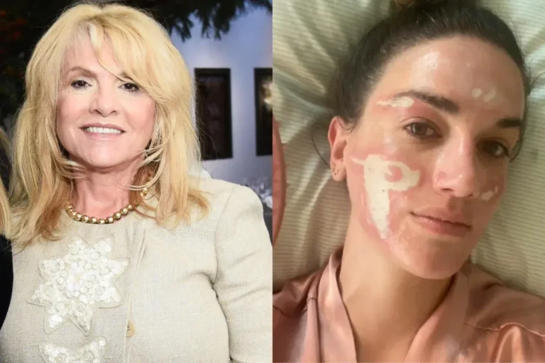 Esteticista de famosas causa lesões e perde licença de trabalho