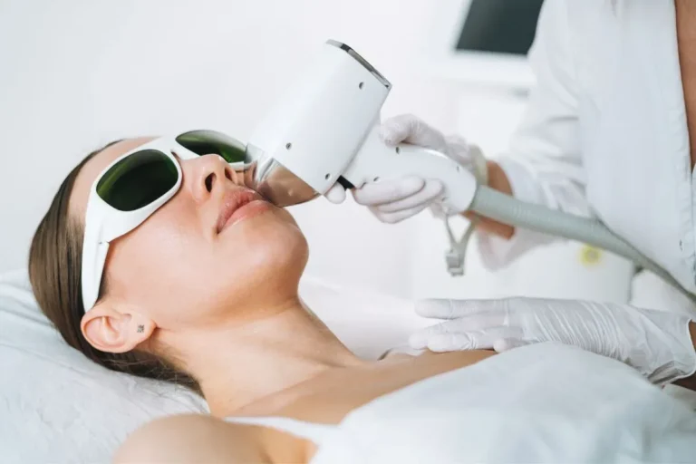 Depilação a laser facial: elimine pelos indesejados com segurança