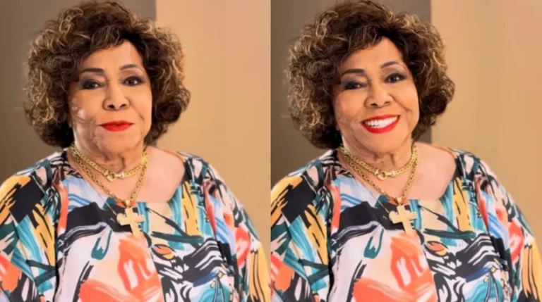 Tendência de estilo: Alcione se recupera após tombo no show