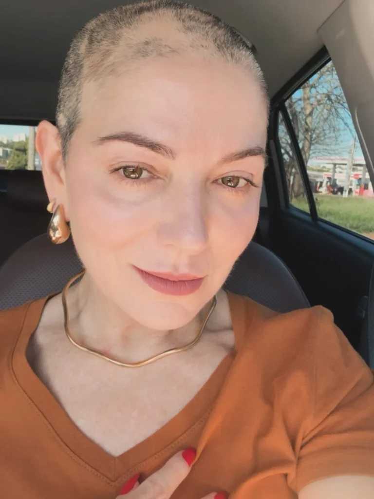 Tendência de estilo: Karina Lucco fala sobre alopecia e confiança