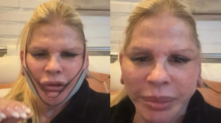 Monique Evans revela novo look pós-cirurgia plástica